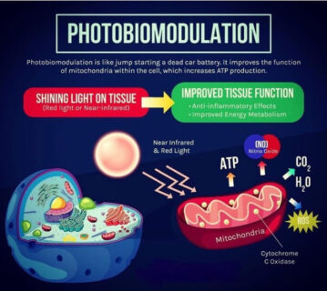 Photobiomodulation Laser Therapy eliminates pain, decreases inflammation, increases blood flow, accelerates healing
